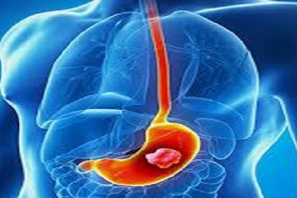 Gastrointestinal Oncology