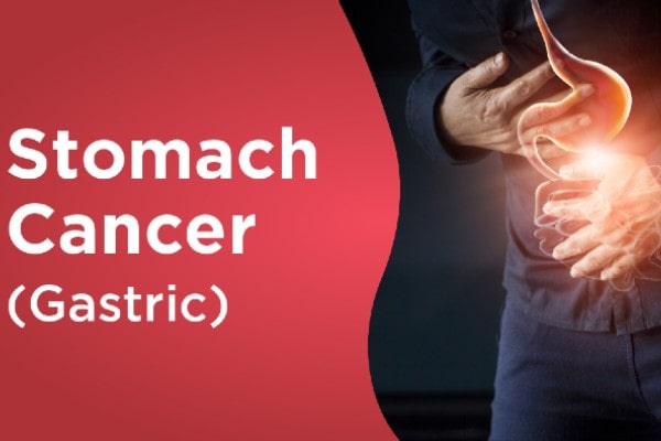Signs and Symptoms of Stomach Cancer