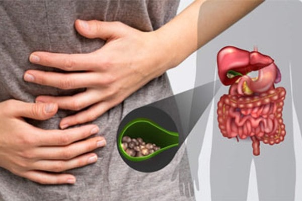 Commonly Asked Questions about Gallbladder and Gallstones?