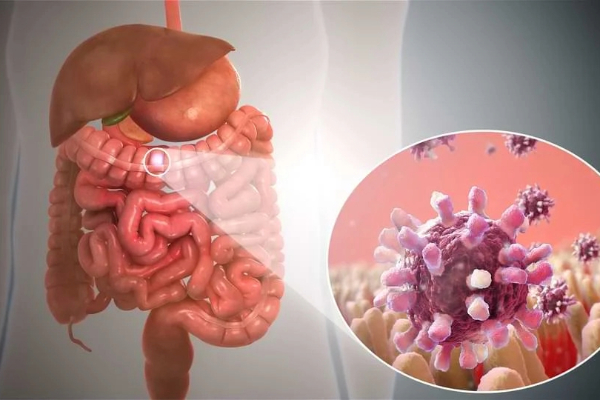 Early Signs of Gastrointestinal Cancers: What You Should Never Ignore