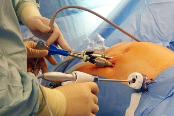 Everything About GI Surgery