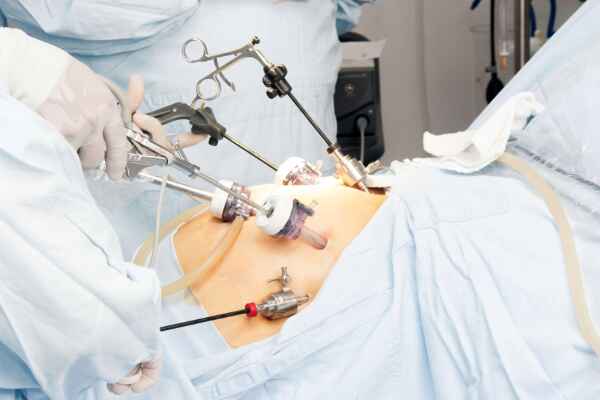 Exploring Laparoscopic Procedures with Dr. Lohith U, Leading Gastroenterologist in Bangalore