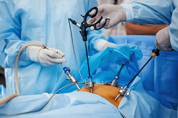 Laparoscopic Surgery for Treating Gastrointestinal Disorders?