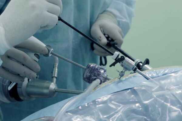 Navigating Common Laparoscopic Procedures: A Guide to Minimally Invasive Surgery