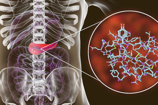 The Rise of Fatty Pancreas: Symptoms, Causes, Risks, and Treatment